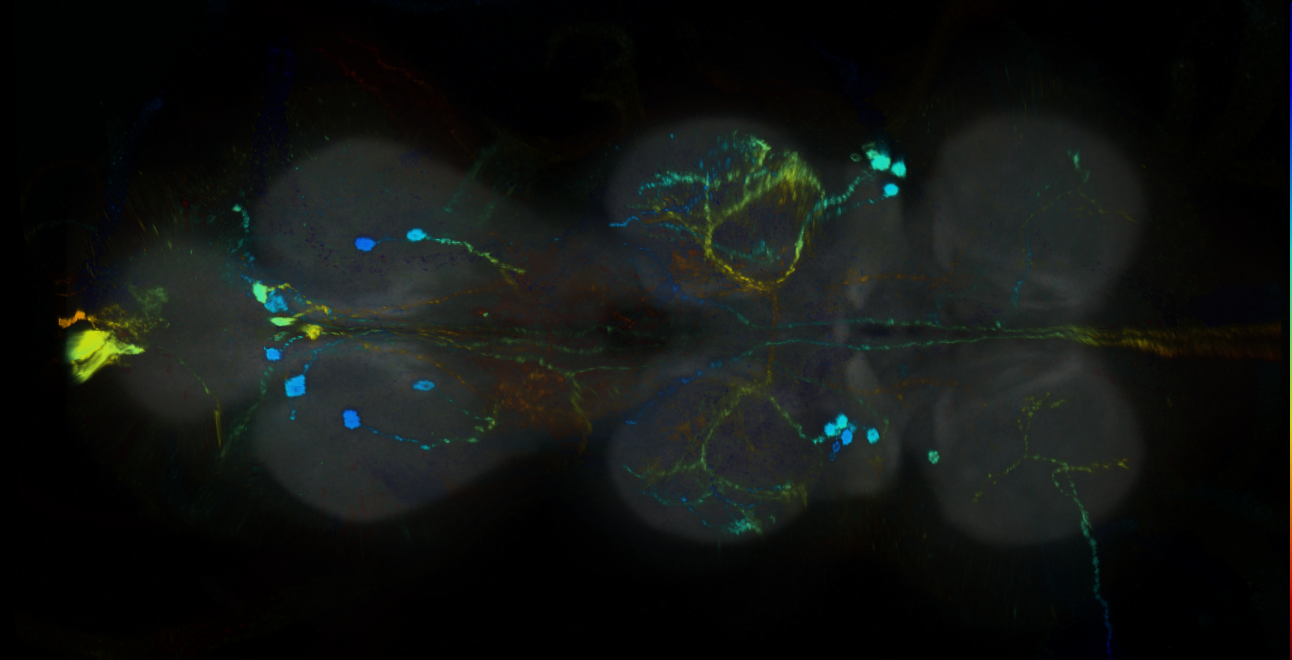 P{GMR21D03-GAL4} expression pattern