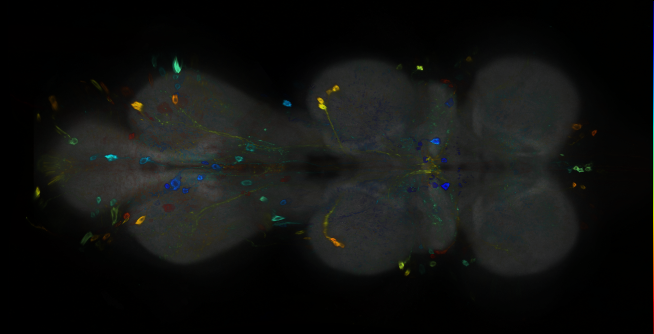 P{GMR21D06-GAL4} expression pattern