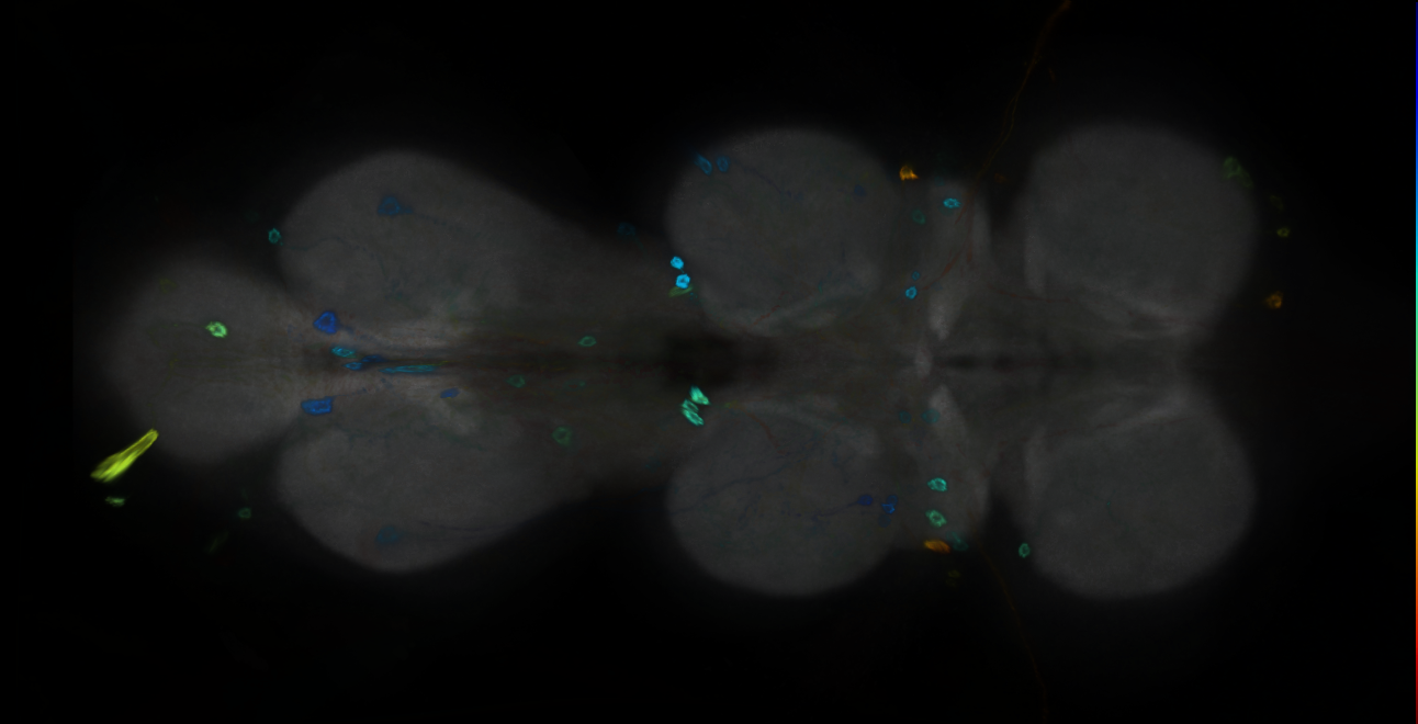 P{GMR21D07-GAL4} expression pattern