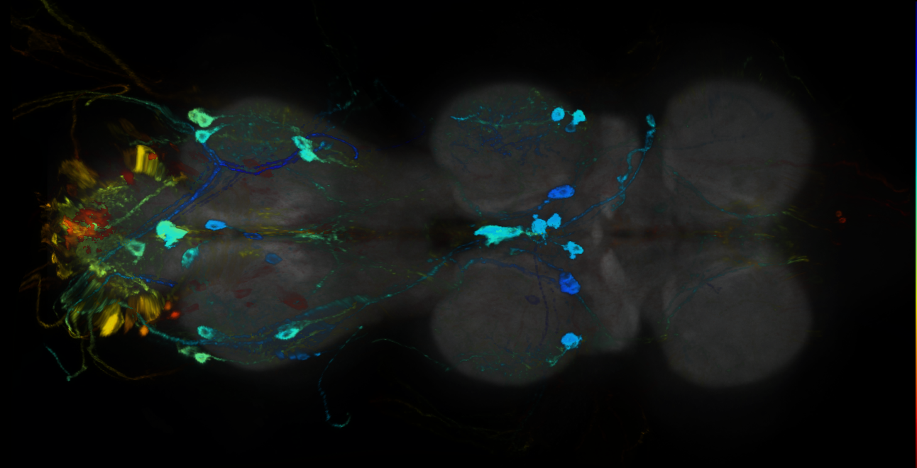 P{GMR21D11-GAL4} expression pattern