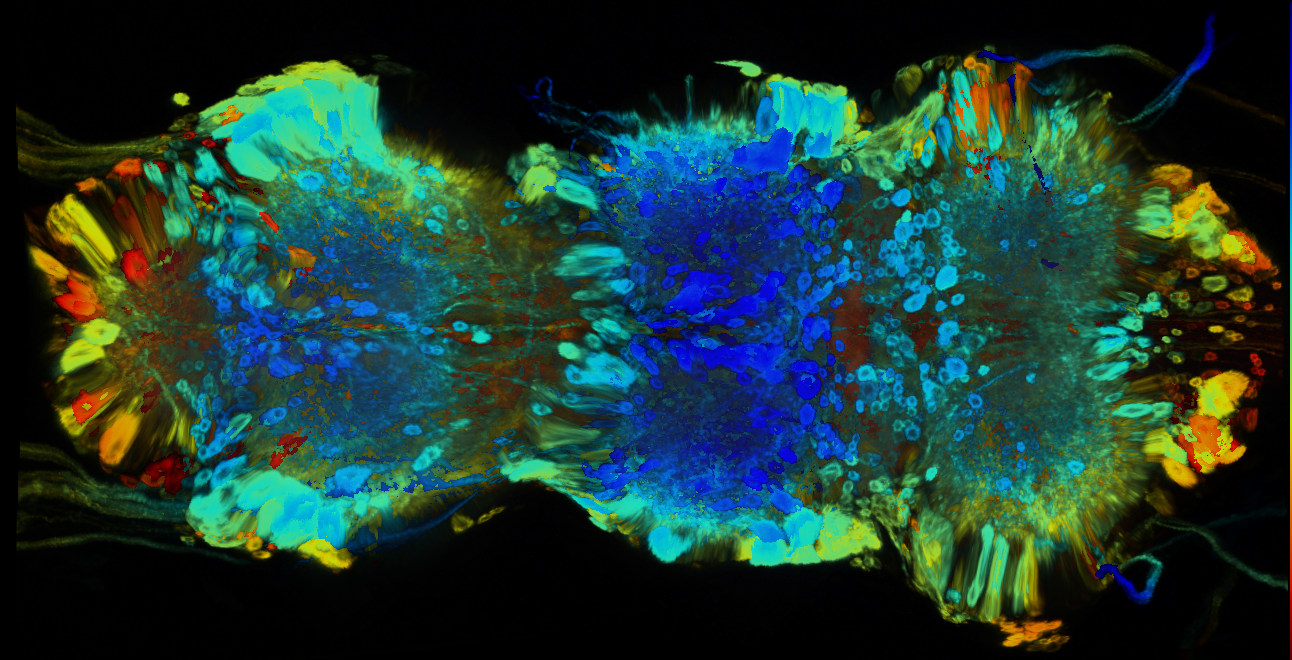 P{GMR21E01-GAL4} expression pattern
