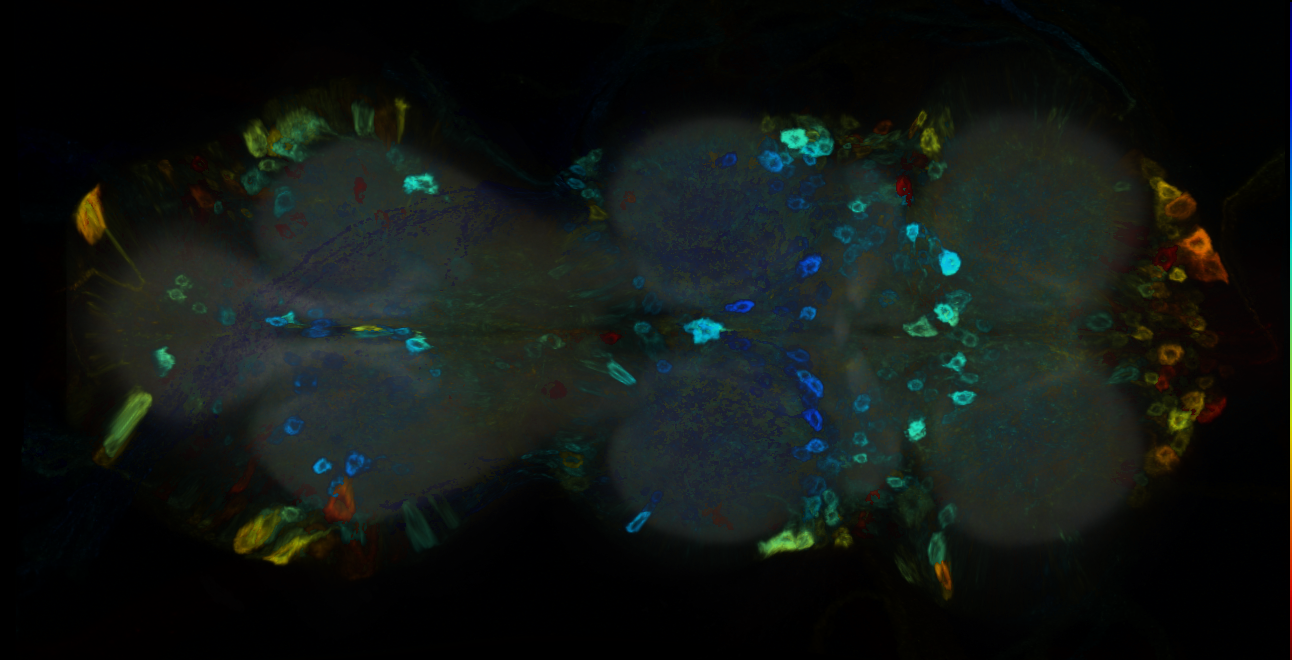 P{GMR21E07-GAL4} expression pattern