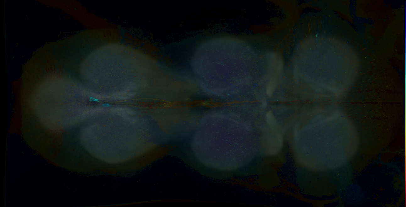 P{GMR21E08-GAL4} expression pattern