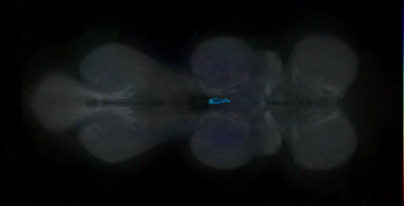 P{GMR21F04-GAL4} expression pattern
