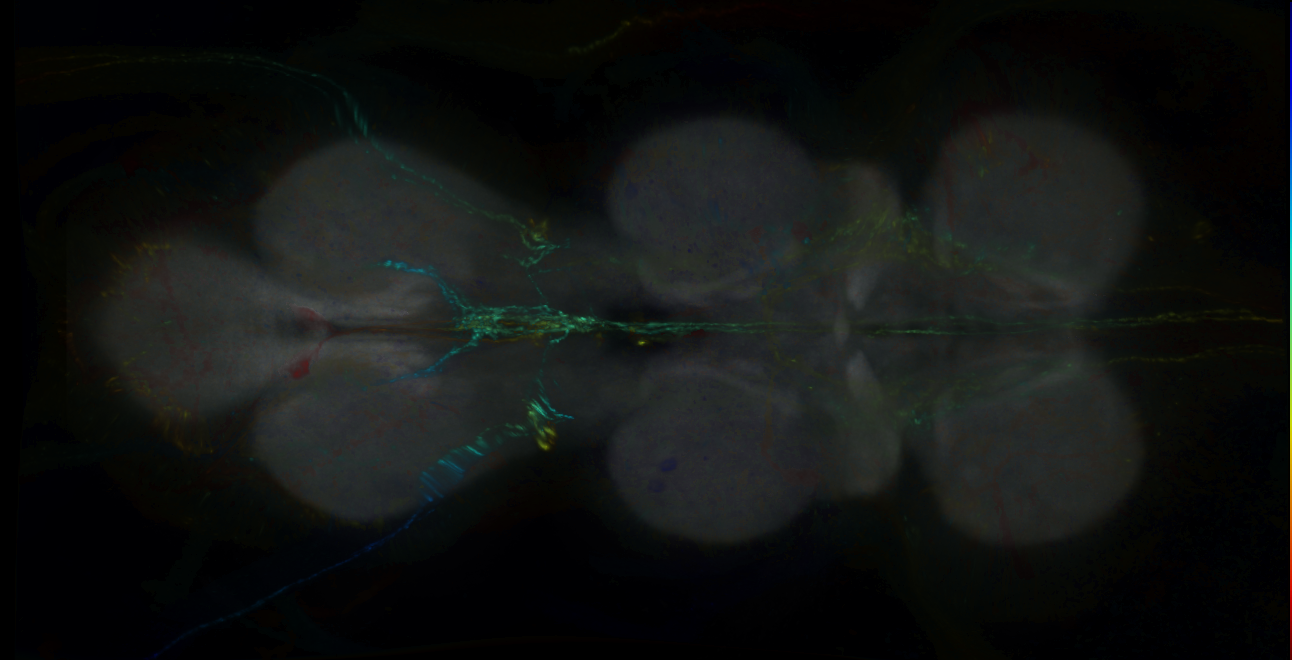 P{GMR21G08-GAL4} expression pattern