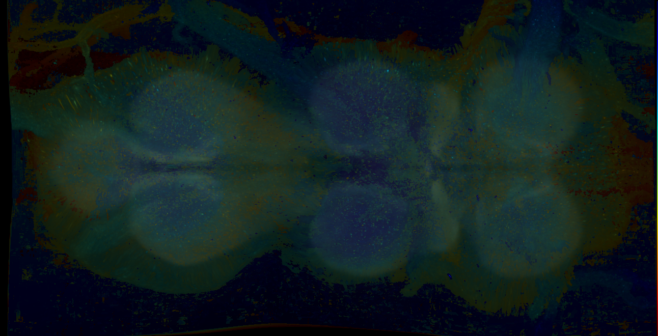 P{GMR21H08-GAL4} expression pattern