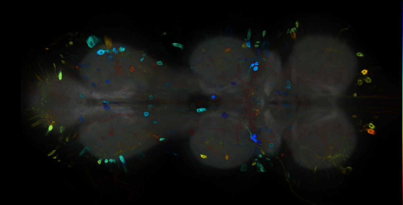 P{GMR22A02-GAL4} expression pattern