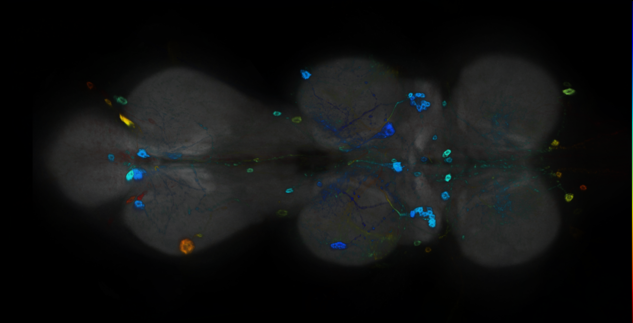 P{GMR22A05-GAL4} expression pattern