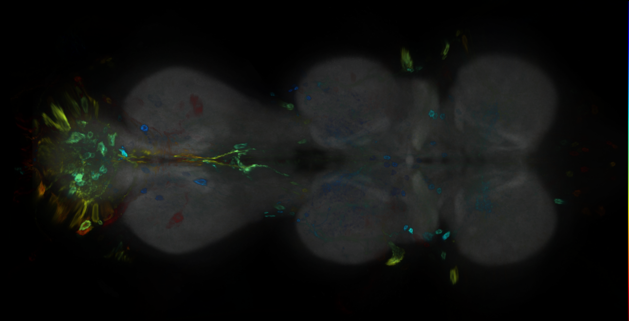 P{GMR22B02-GAL4} expression pattern