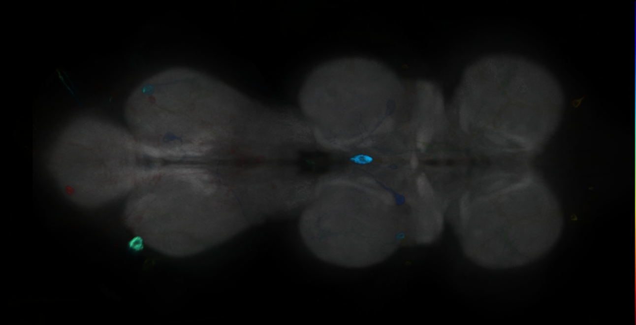 P{GMR22B05-GAL4} expression pattern