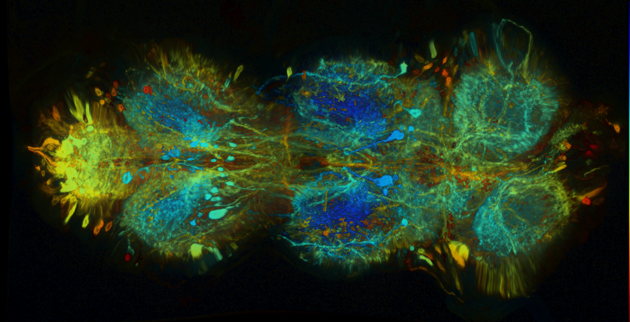 P{GMR22B07-GAL4} expression pattern