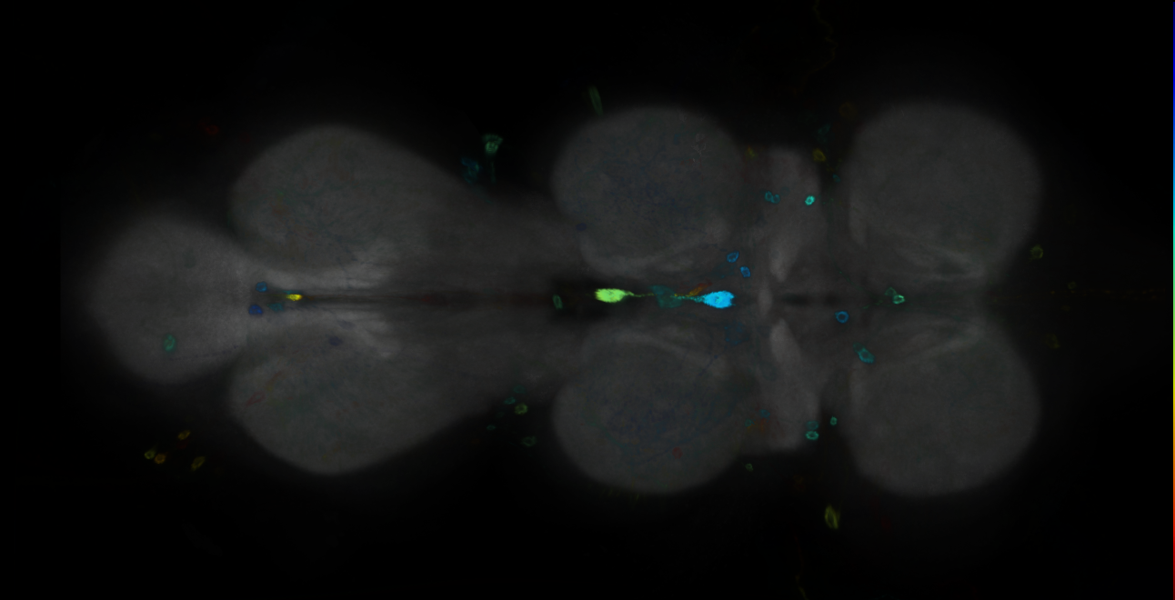 P{GMR22B11-GAL4} expression pattern