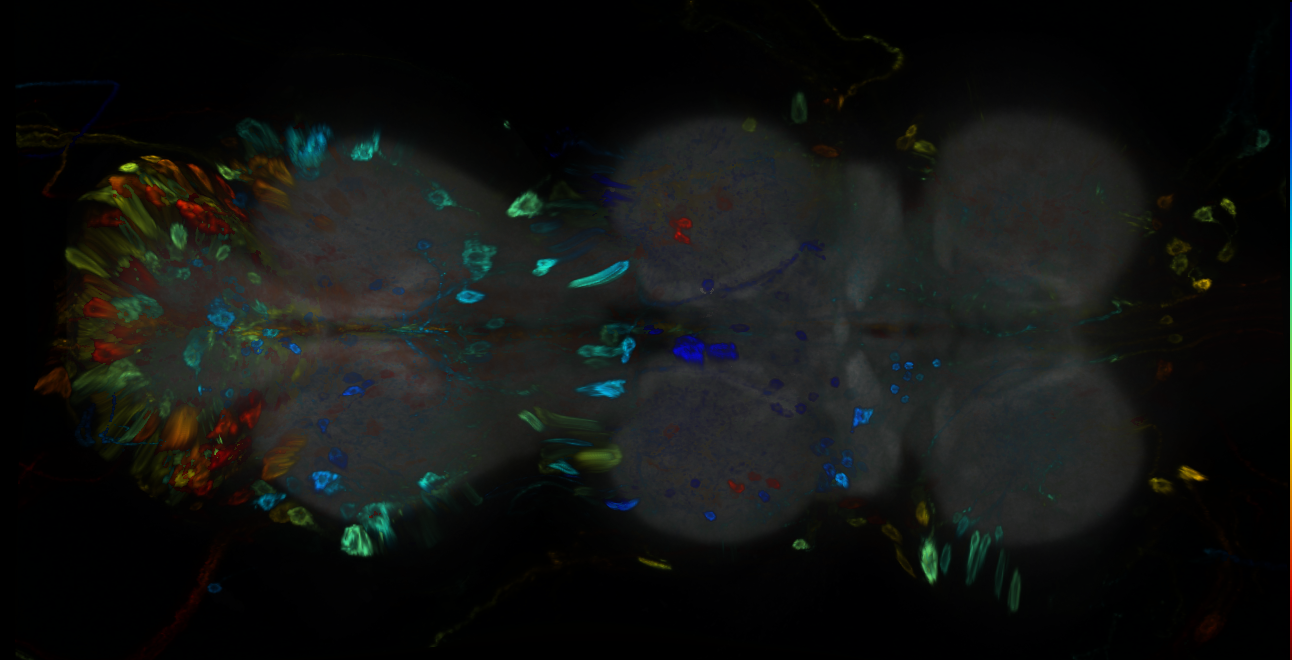 P{GMR22C05-GAL4} expression pattern