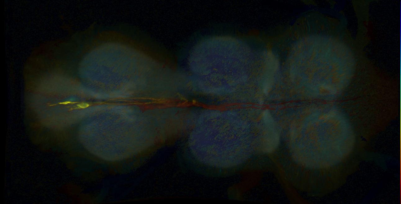 P{GMR22C06-GAL4} expression pattern
