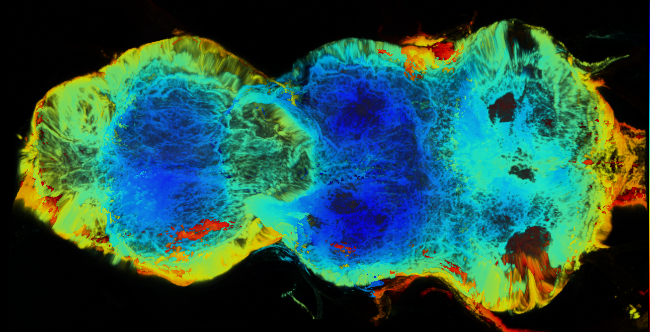 P{GMR22D05-GAL4} expression pattern