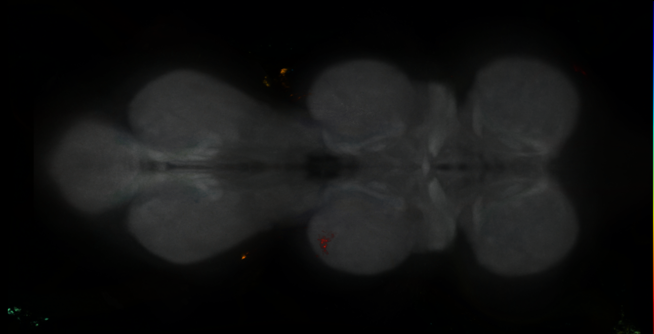P{GMR22F02-GAL4} expression pattern