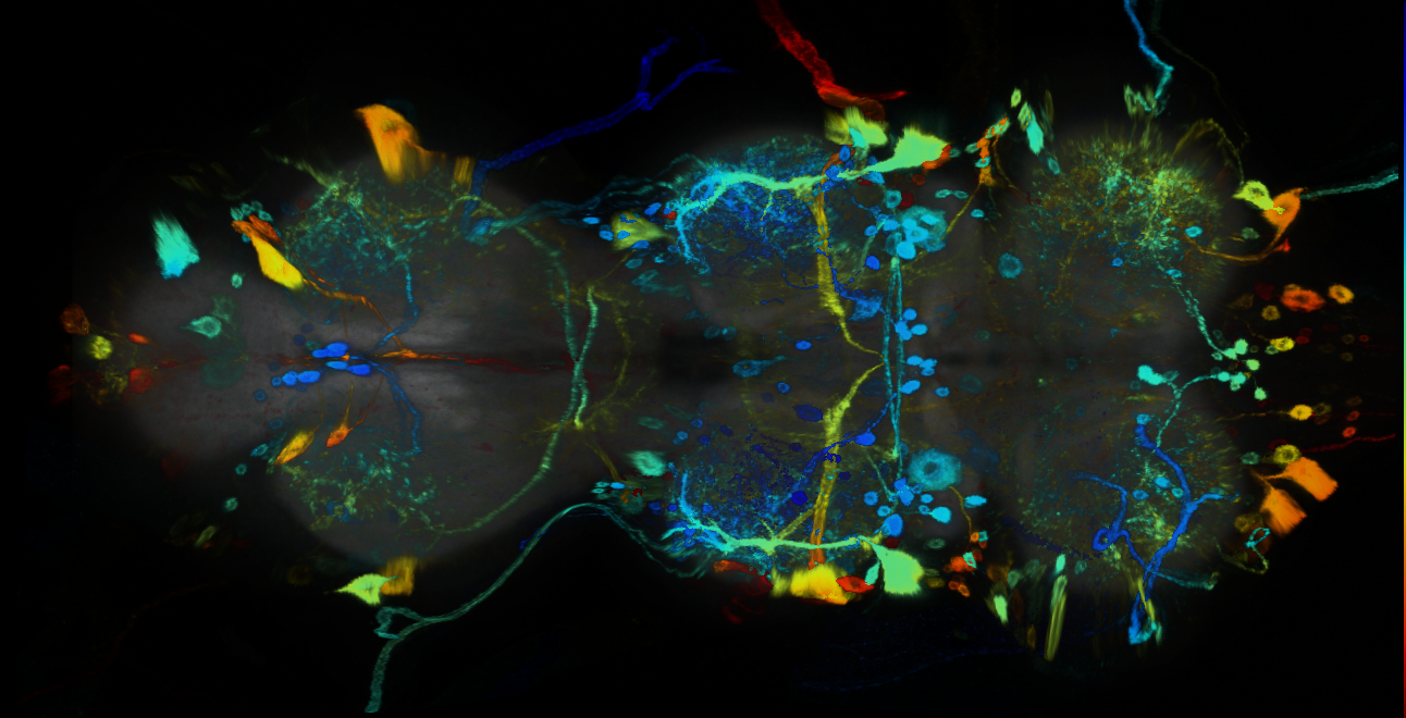 P{GMR22G11-GAL4} expression pattern