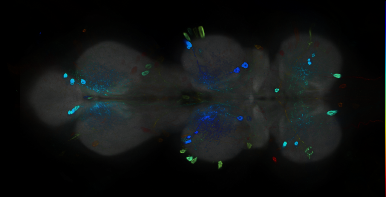 P{GMR22H02-GAL4} expression pattern