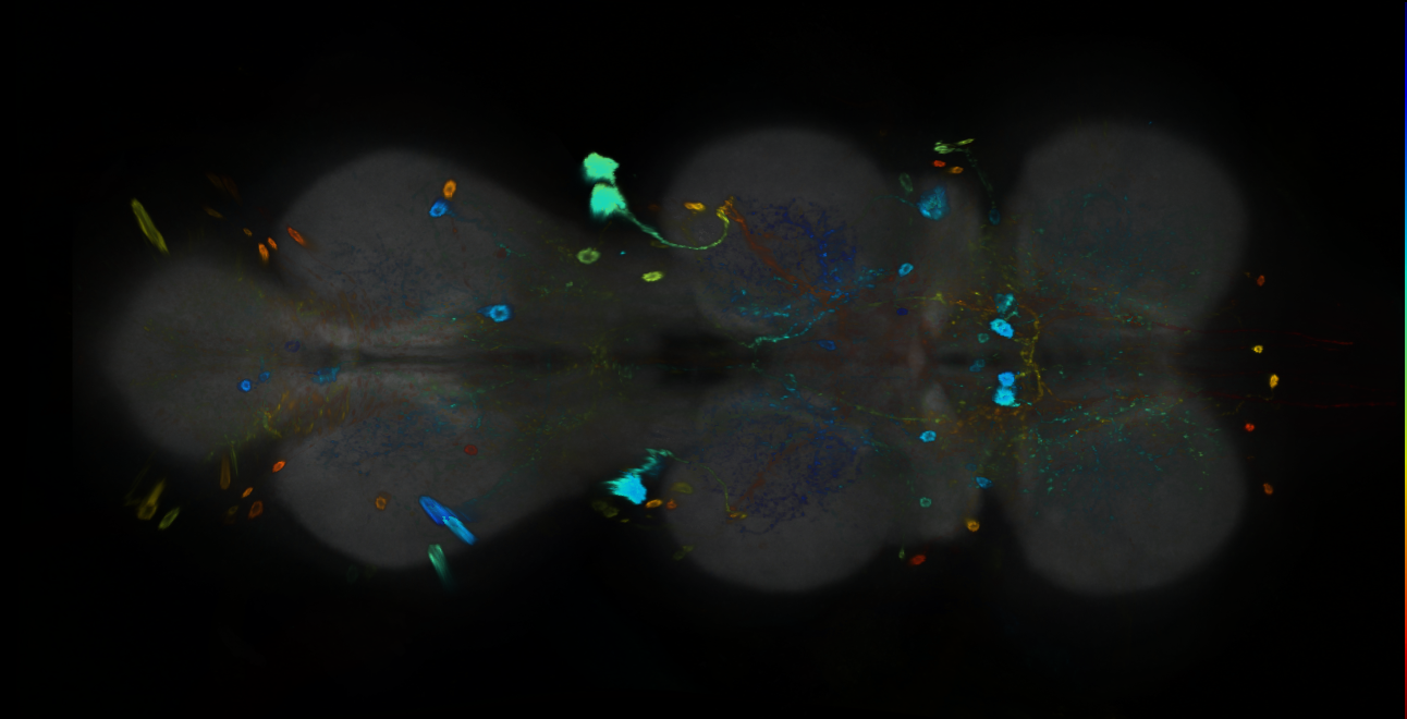 P{GMR22H11-GAL4} expression pattern
