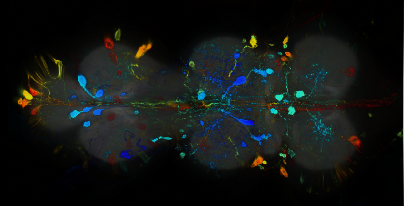 P{GMR23A11-GAL4} expression pattern