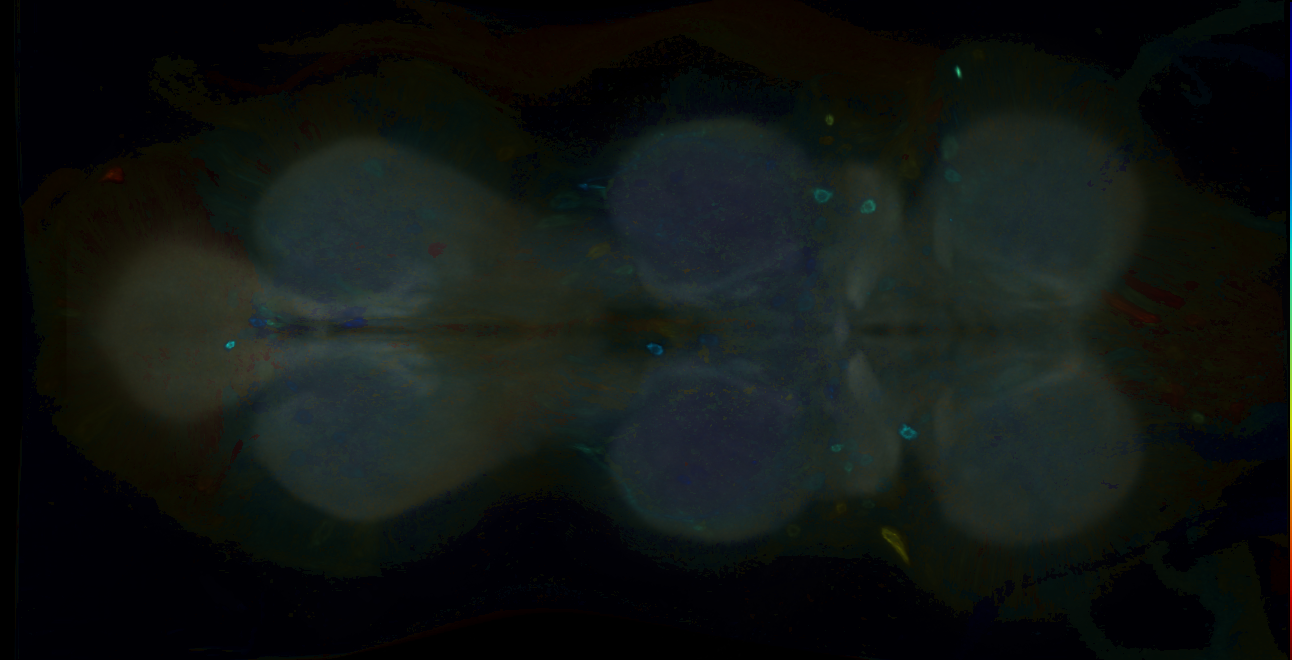 P{GMR23D09-GAL4} expression pattern