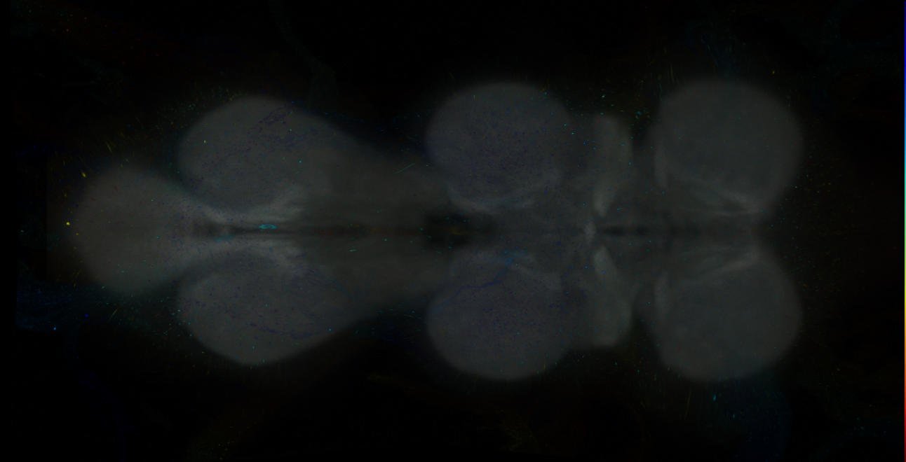 P{GMR23D11-GAL4} expression pattern