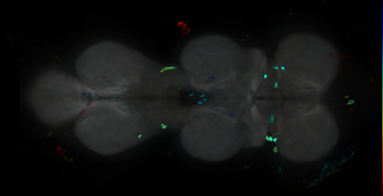 P{GMR23G11-GAL4} expression pattern