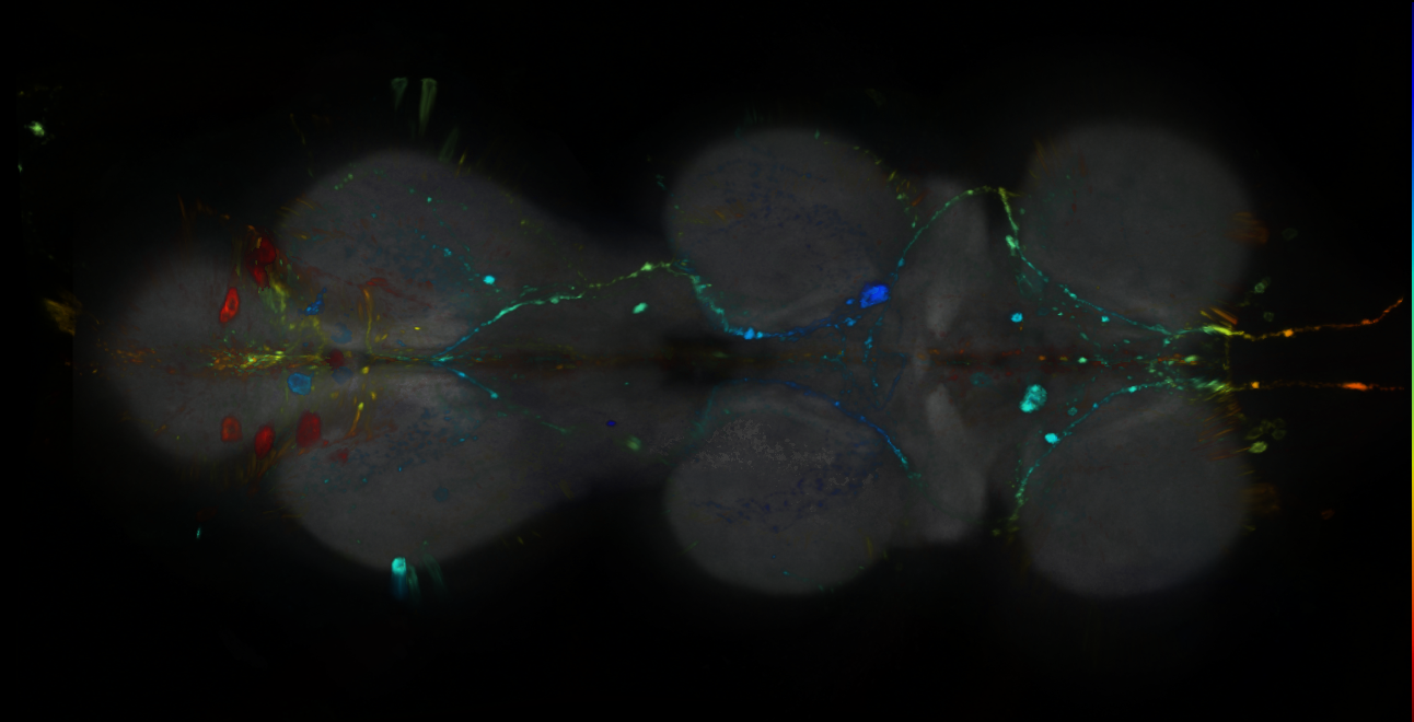 P{GMR23H04-GAL4} expression pattern