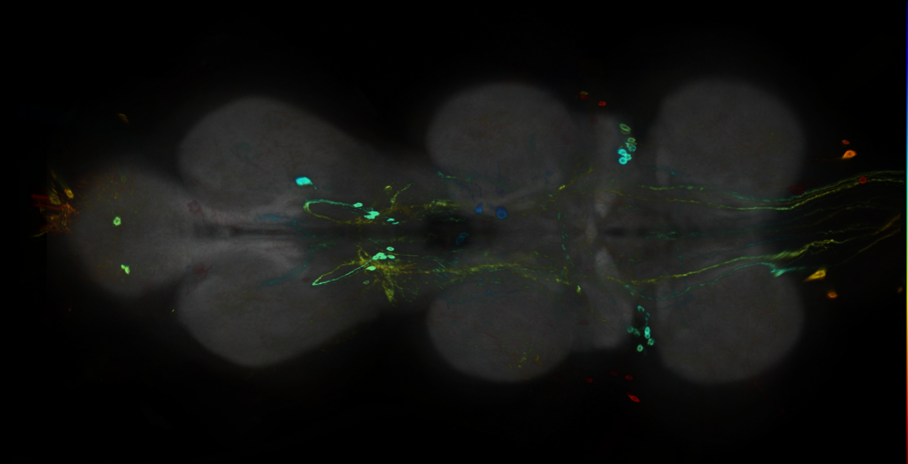 P{GMR23H08-GAL4} expression pattern
