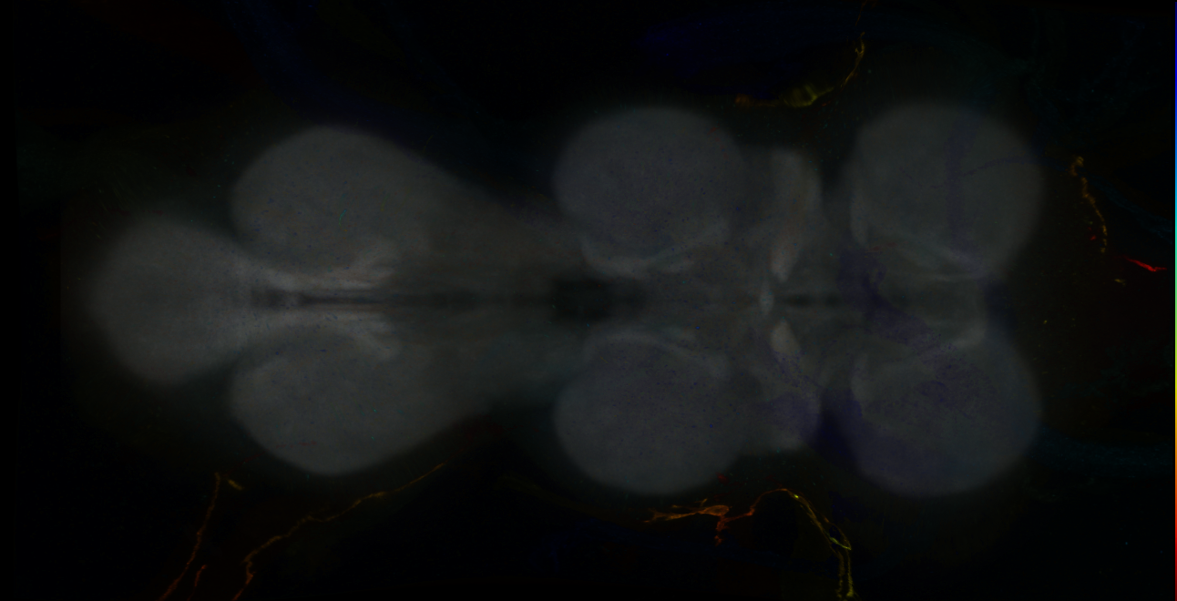 P{GMR24A09-GAL4} expression pattern