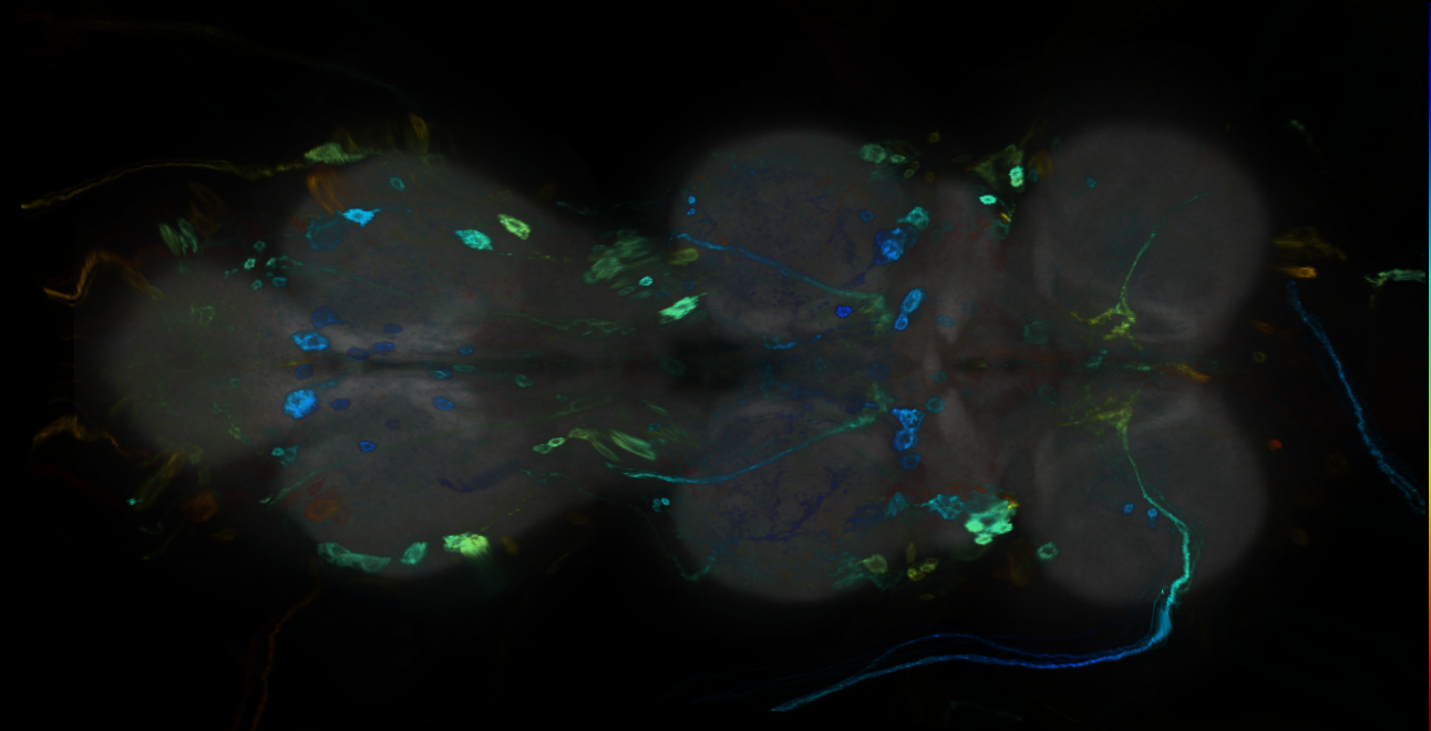 P{GMR24B04-GAL4} expression pattern