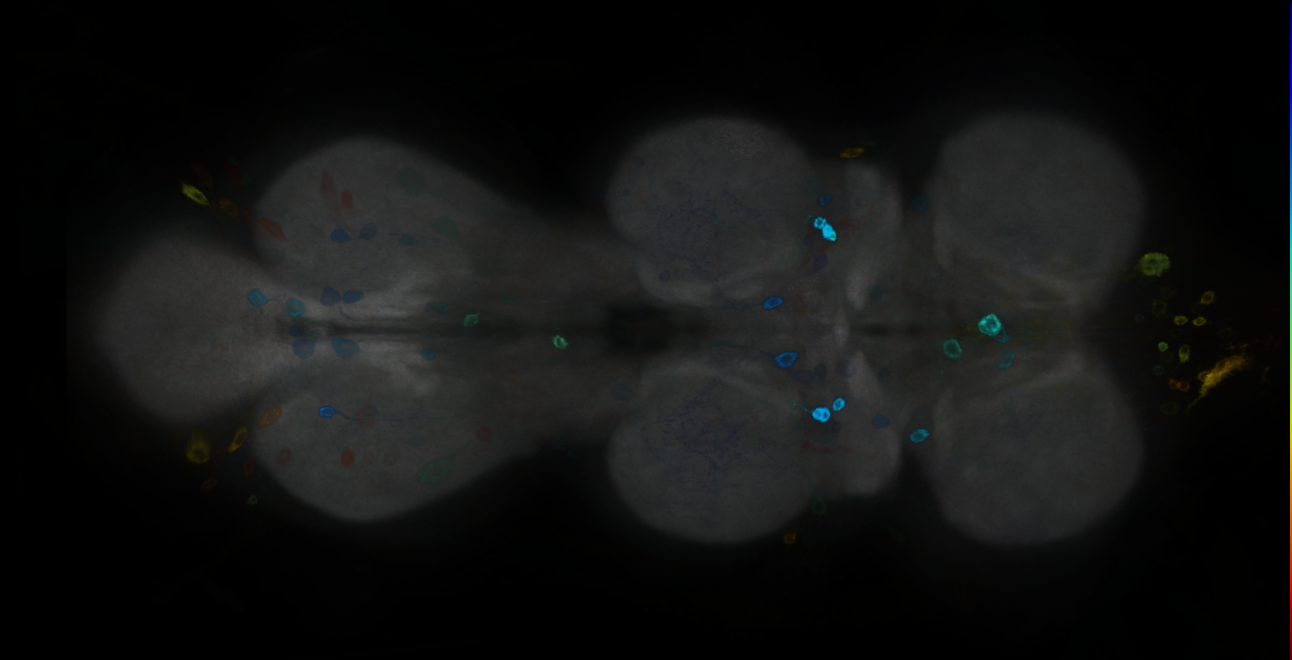 P{GMR25A06-GAL4} expression pattern
