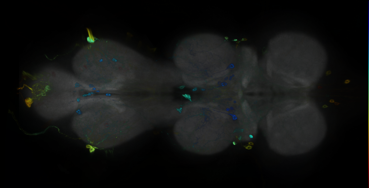 P{GMR25A07-GAL4} expression pattern