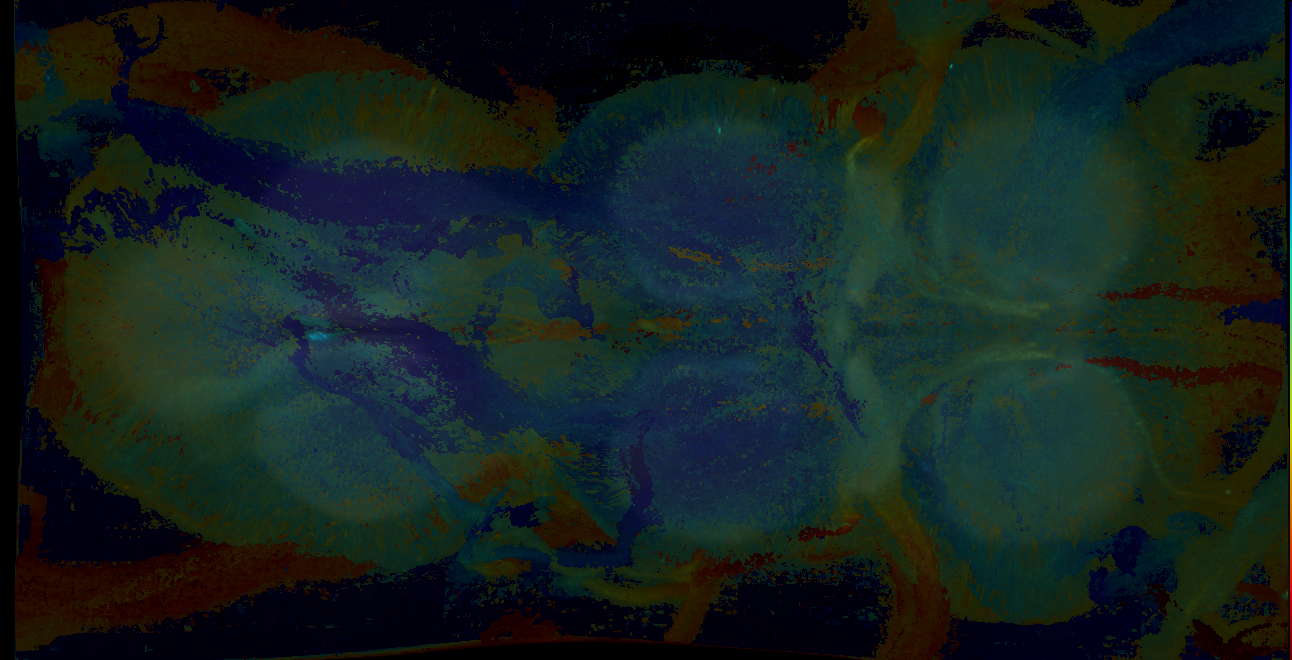P{GMR25A08-GAL4} expression pattern