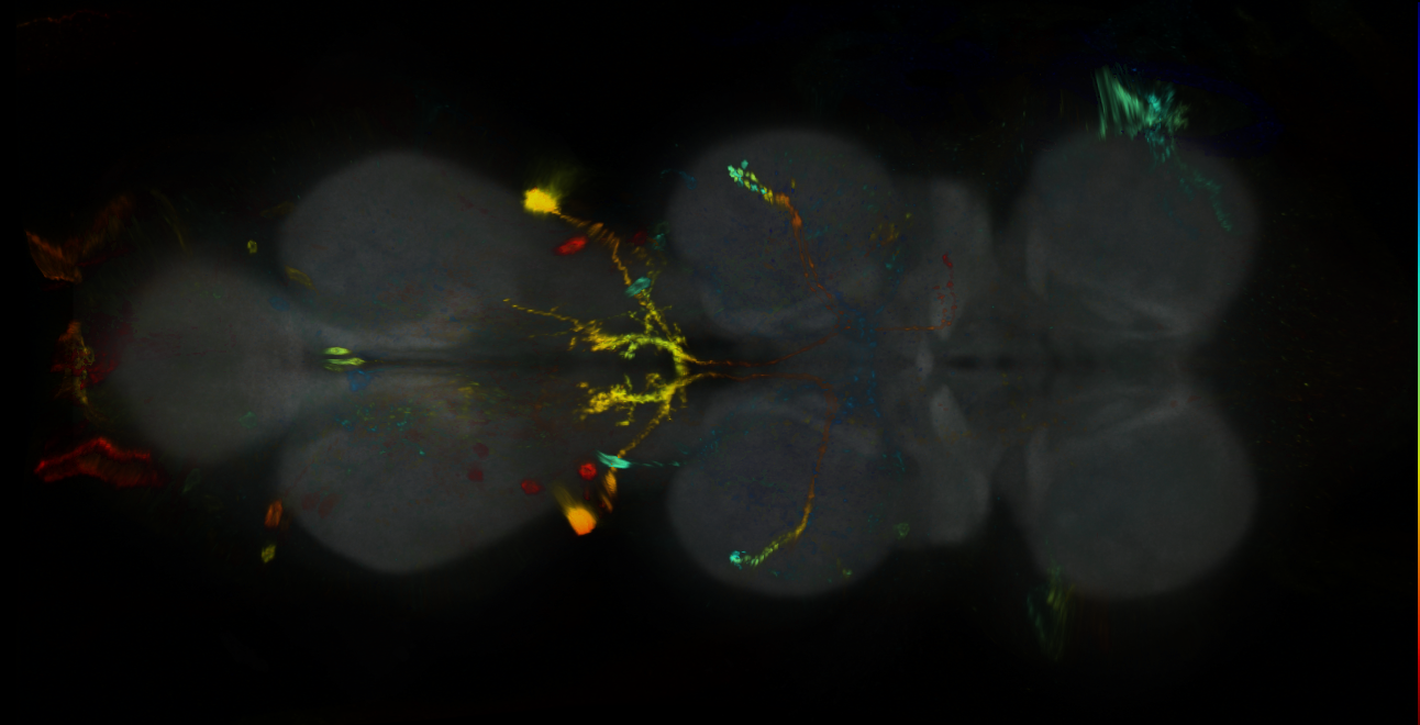 P{GMR25A11-GAL4} expression pattern