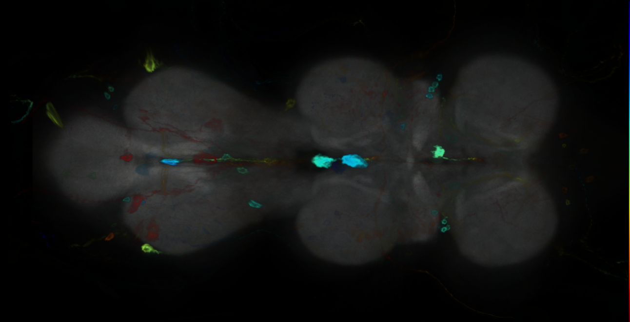 P{GMR25B03-GAL4} expression pattern