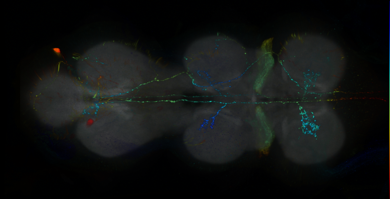 P{GMR25B04-GAL4} expression pattern