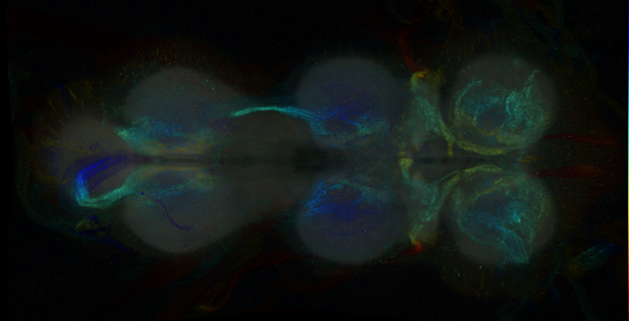 P{GMR25B08-GAL4} expression pattern