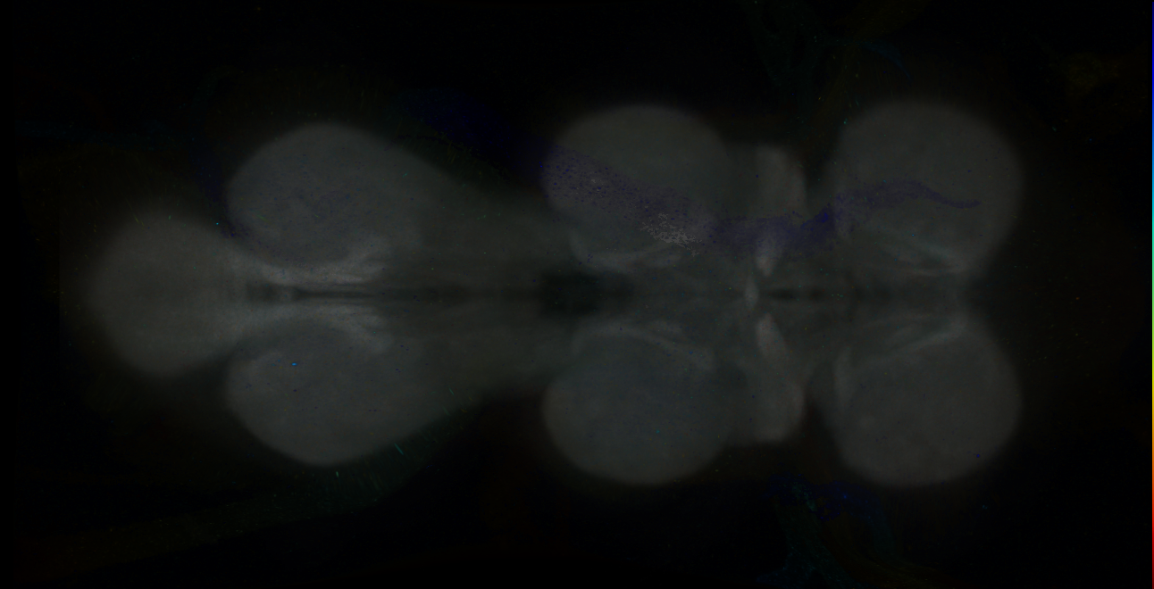 P{GMR25B09-GAL4} expression pattern