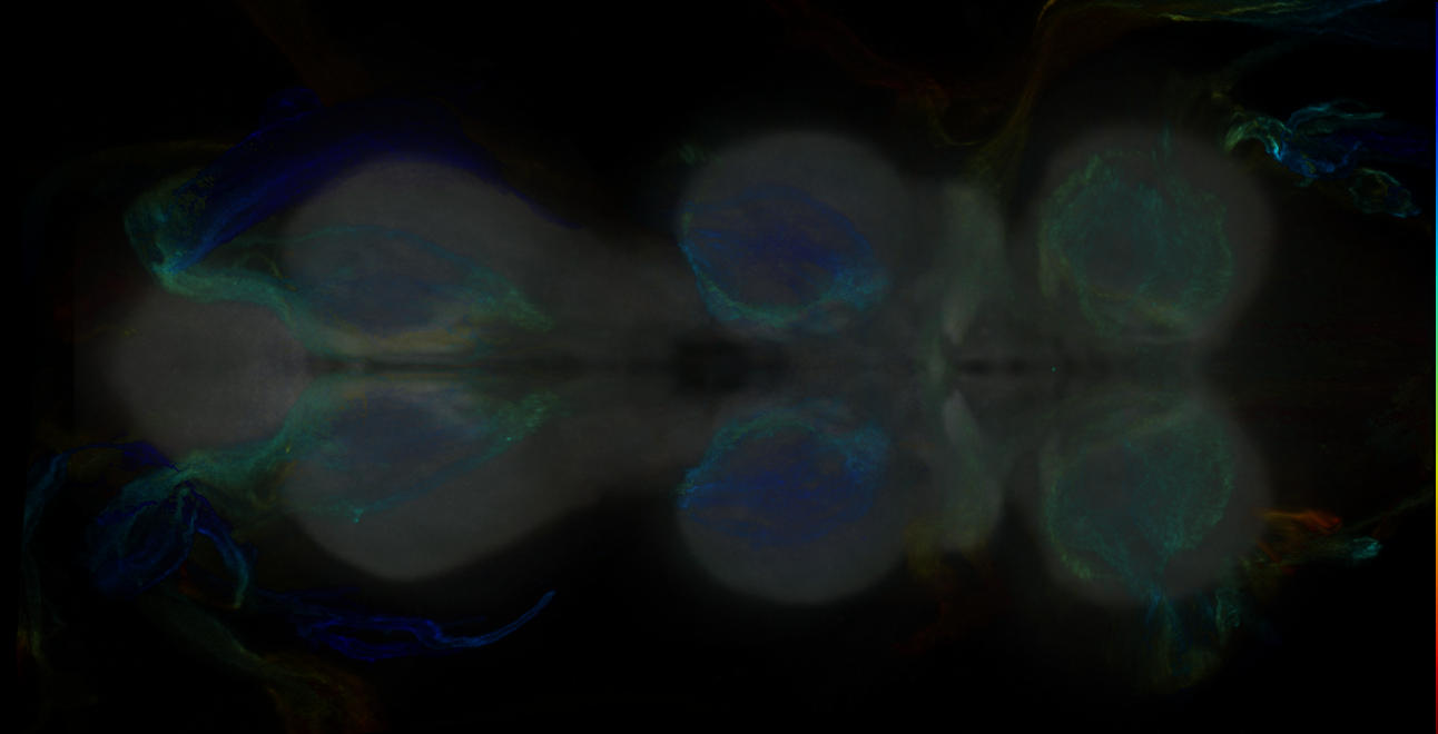 P{GMR25B11-GAL4} expression pattern