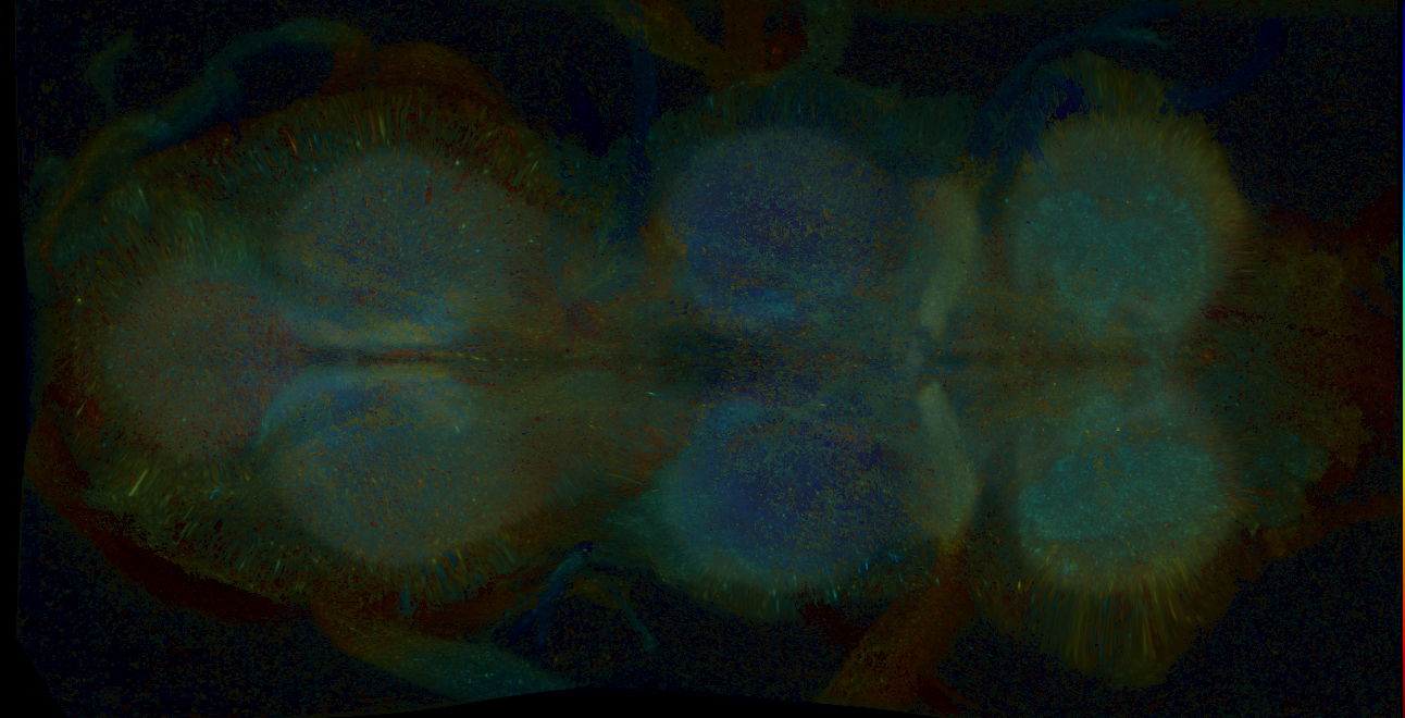 P{GMR25C06-GAL4} expression pattern