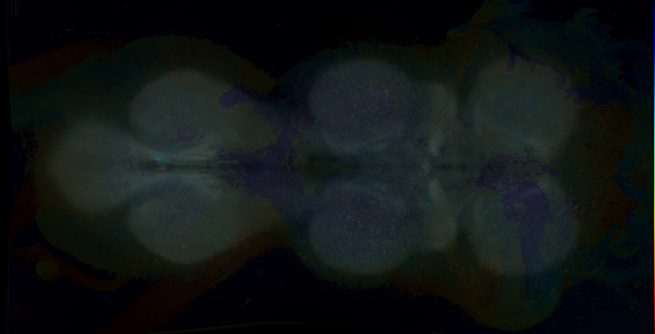 P{GMR25C10-GAL4} expression pattern