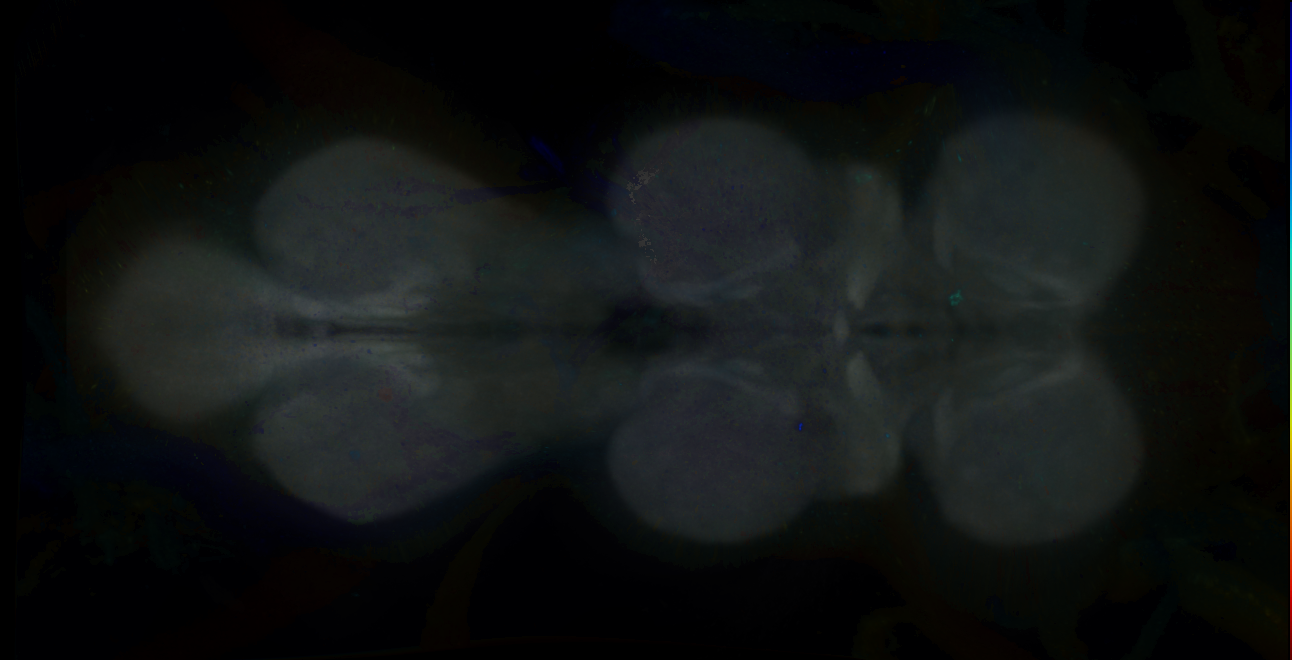 P{GMR25D02-GAL4} expression pattern