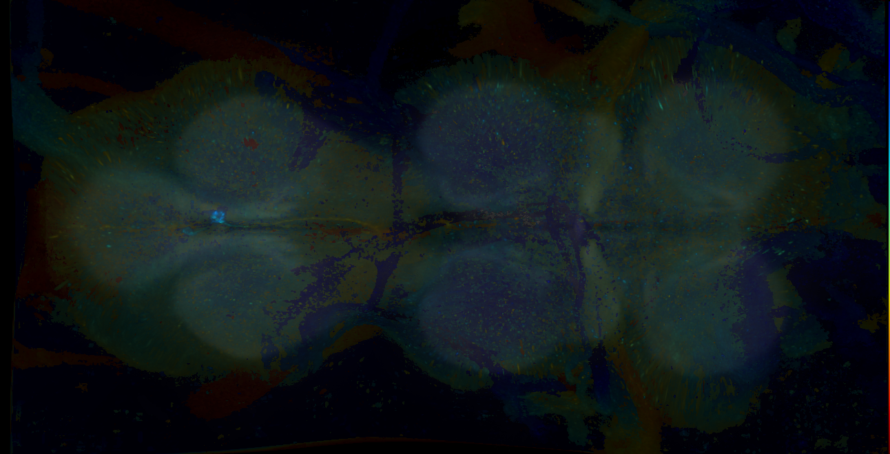 P{GMR25D05-GAL4} expression pattern