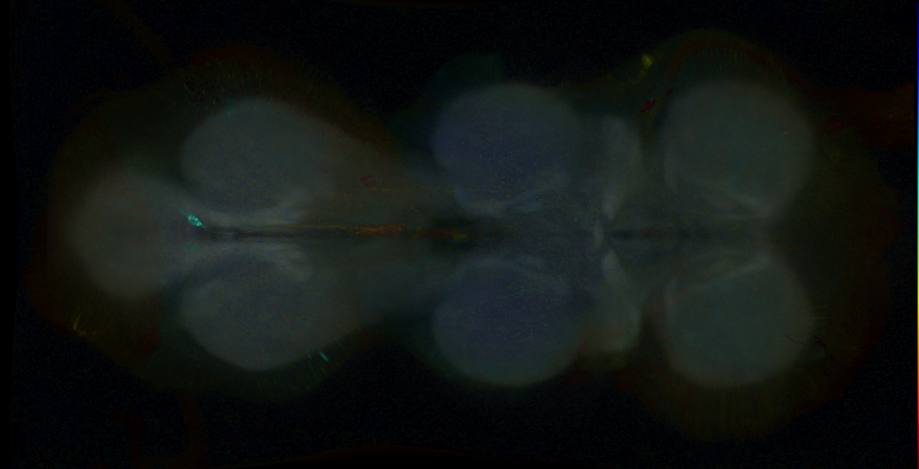 P{GMR25D07-GAL4} expression pattern