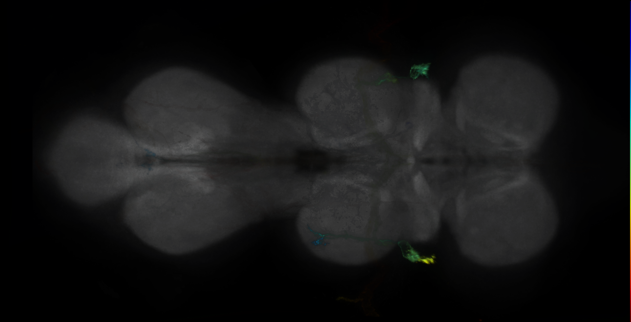 P{GMR25D08-GAL4} expression pattern