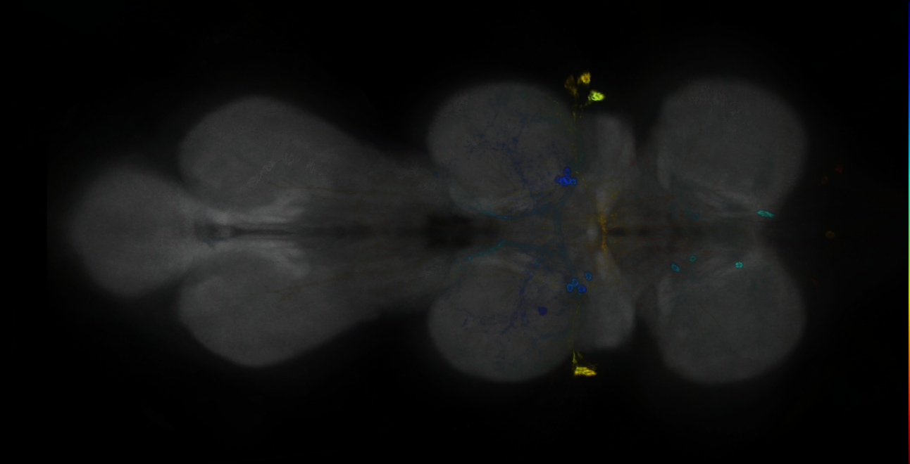 P{GMR25D10-GAL4} expression pattern