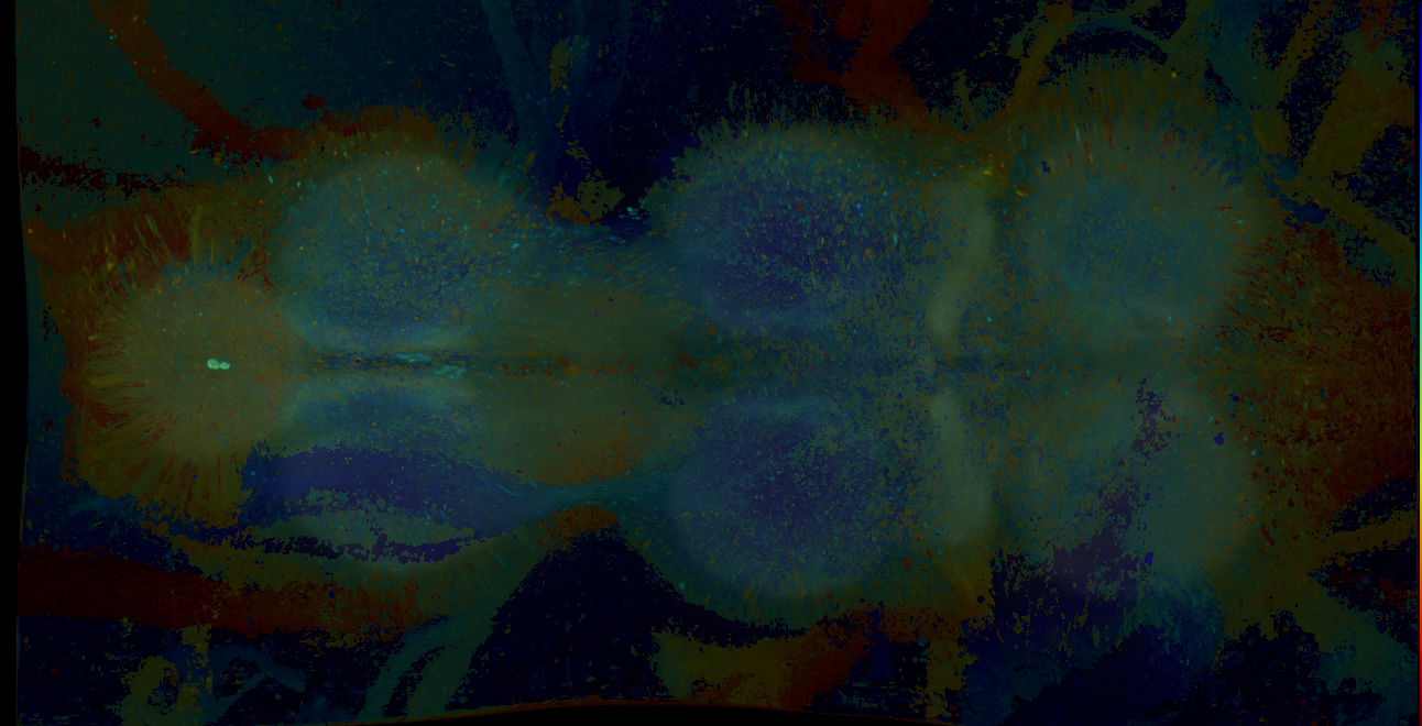 P{GMR25E03-GAL4} expression pattern