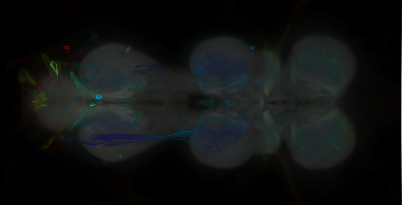 P{GMR25E10-GAL4} expression pattern