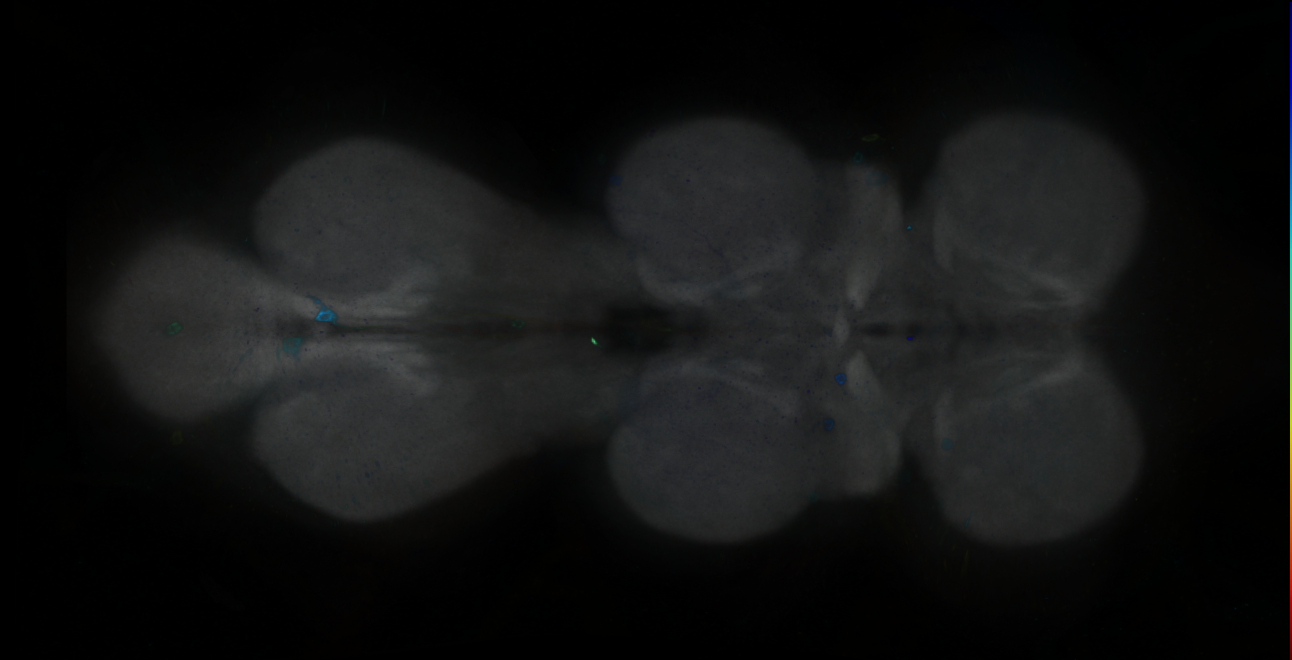 P{GMR25E11-GAL4} expression pattern